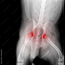 Displasia Articular