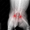 Displasia Articular