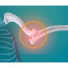 Degeneración de las articulaciones y la columna vertebral